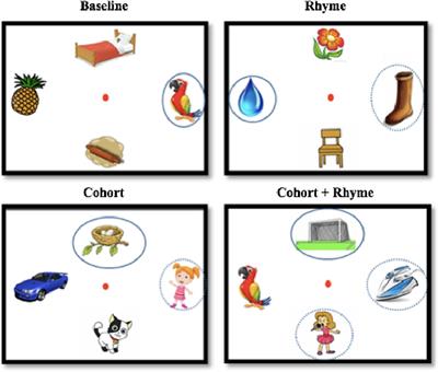 Visual attention and phonological processing in children with developmental language disorder